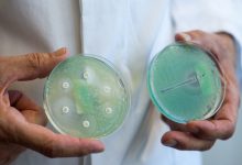Фото - Биологи нашли уничтожающий бактерии токсин, атакующий их РНК