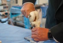Фото - Ортопеды разработали имплант-амортизатор против боли в колене с эффективностью до 86%