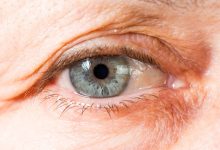 Фото - Медики объяснили, почему дети чаще стали страдать от синдрома сухого глаза