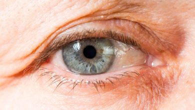Фото - Медики объяснили, почему дети чаще стали страдать от синдрома сухого глаза