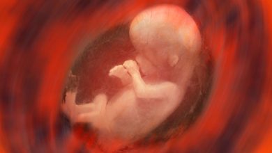 Фото - Индийские врачи извлекли восемь эмбрионов из брюшной полости девочки-младенца