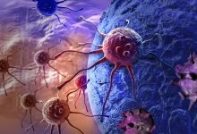 Фото - Онкологи создали вакцины от рака на основе состарившихся раковых клеток