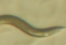 Фото - Ученые обнаружили человеческий ген у прозрачных червей